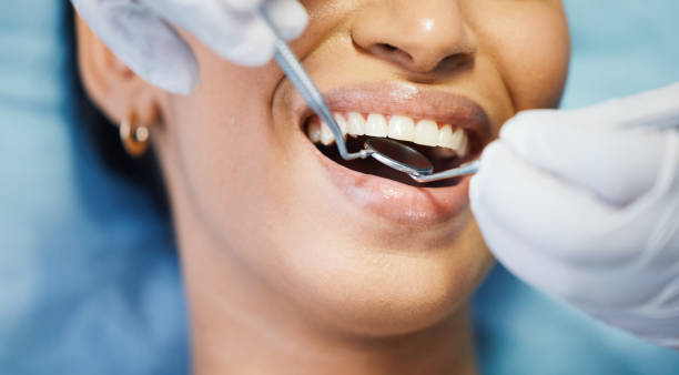Best Pediatric Emergency Dentist in Aliso Viejo, CA
